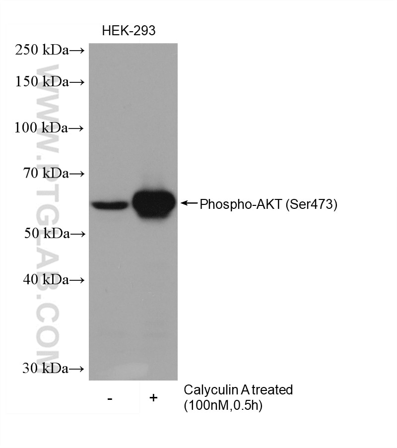 Western Blot (WB) analysis of HEK-293 cells using HRP-conjugated Phospho-AKT (Ser473) Monoclonal ant (HRP-66444)