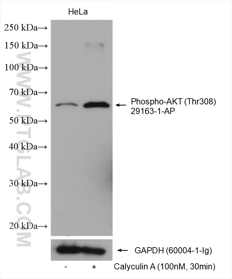 Western Blot (WB) analysis of various lysates using Phospho-AKT (Thr308) Polyclonal antibody (29163-1-AP)