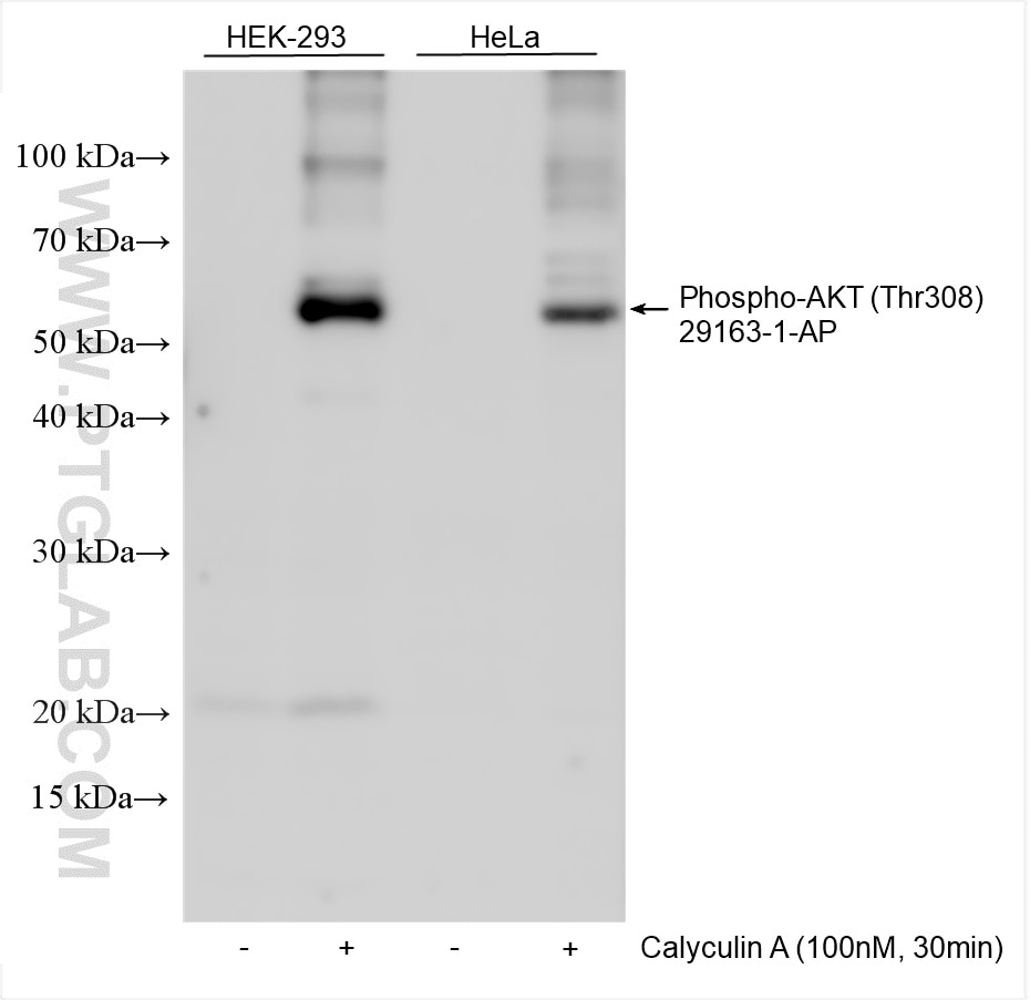 Western Blot (WB) analysis of various lysates using Phospho-AKT (Thr308) Polyclonal antibody (29163-1-AP)