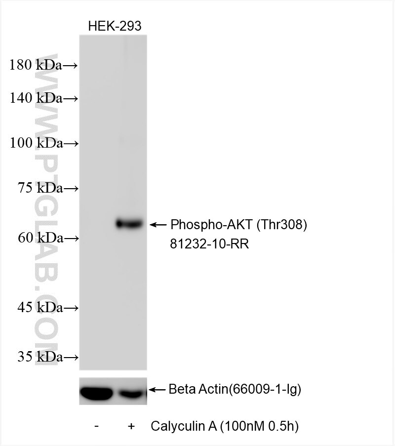 Western Blot (WB) analysis of various lysates using Phospho-AKT (Thr308) Recombinant antibody (81232-10-RR)