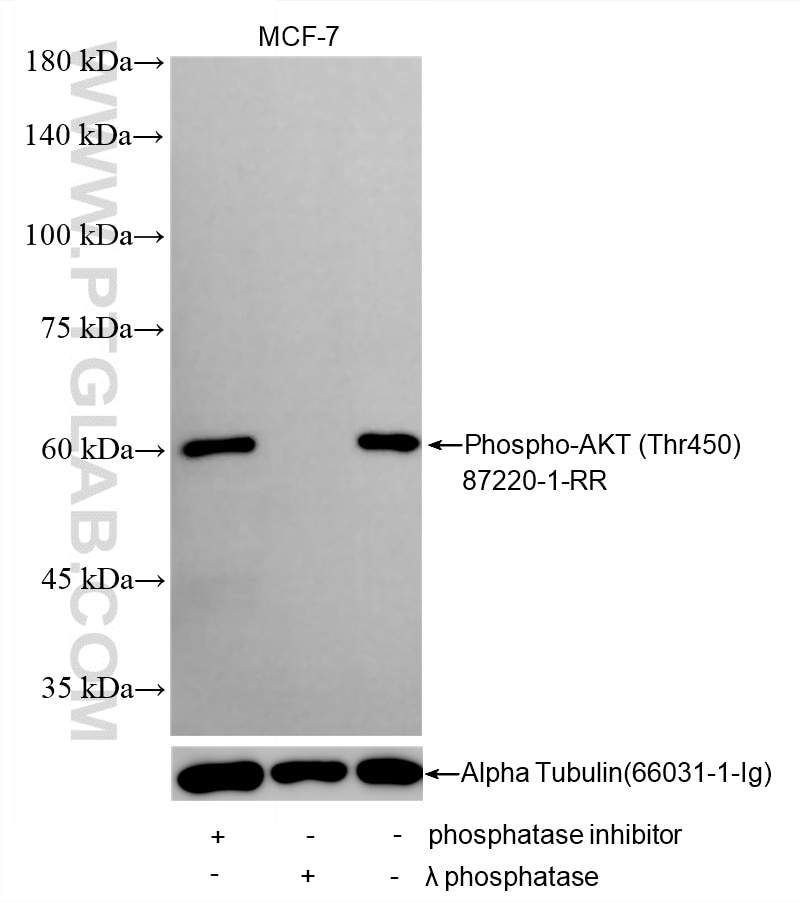 Western Blot (WB) analysis of various lysates using Phospho-AKT (Thr450) Recombinant monoclonal antibo (87220-1-RR)