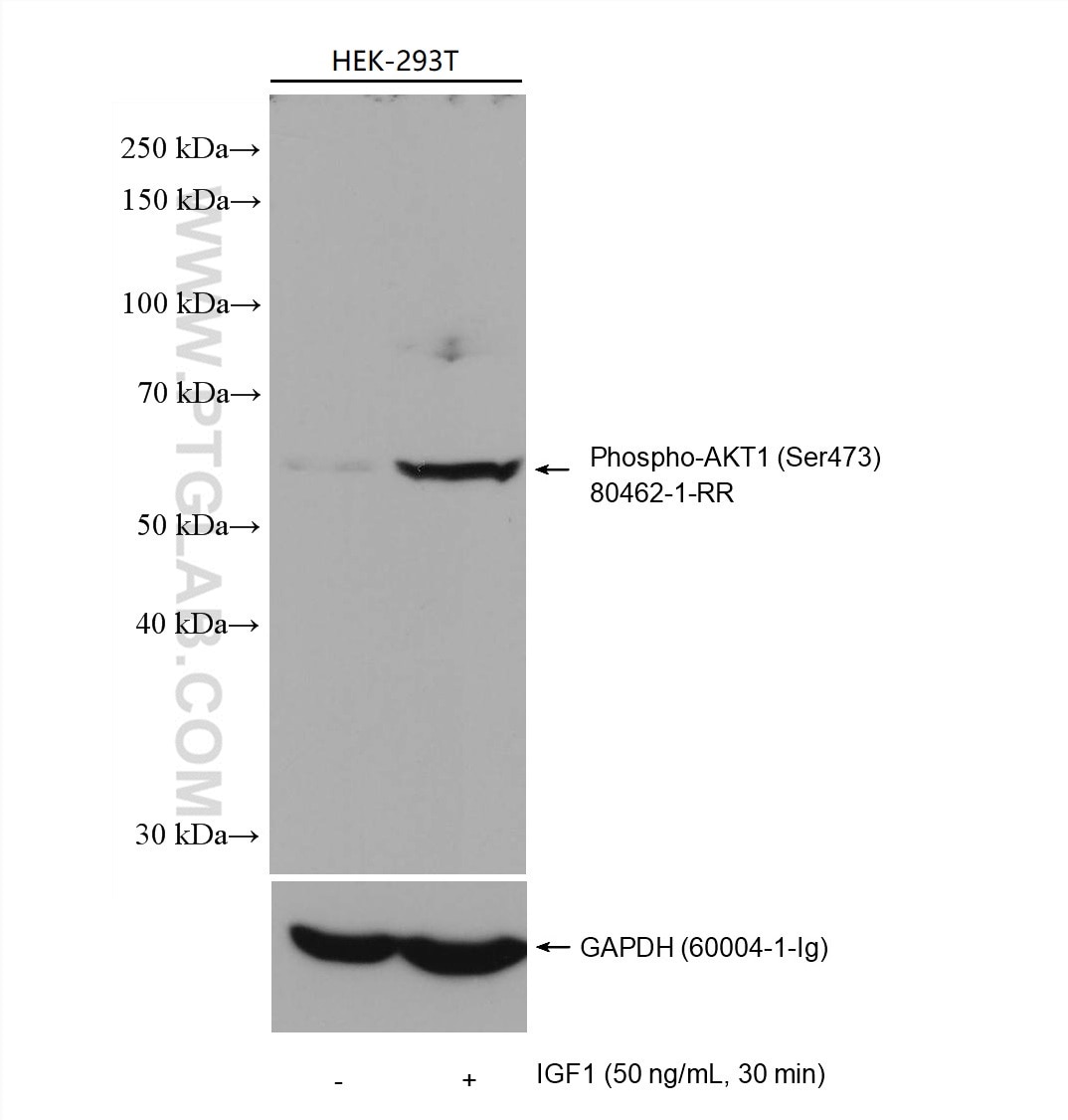 Western Blot (WB) analysis of various lysates using Phospho-AKT1 (Ser473) Recombinant antibody (80462-1-RR)