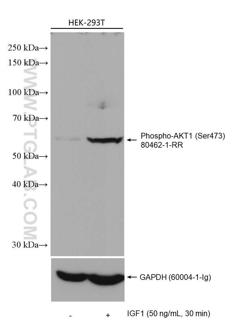 Western Blot (WB) analysis of various lysates using Phospho-AKT1 (Ser473) Recombinant antibody (80462-1-RR)