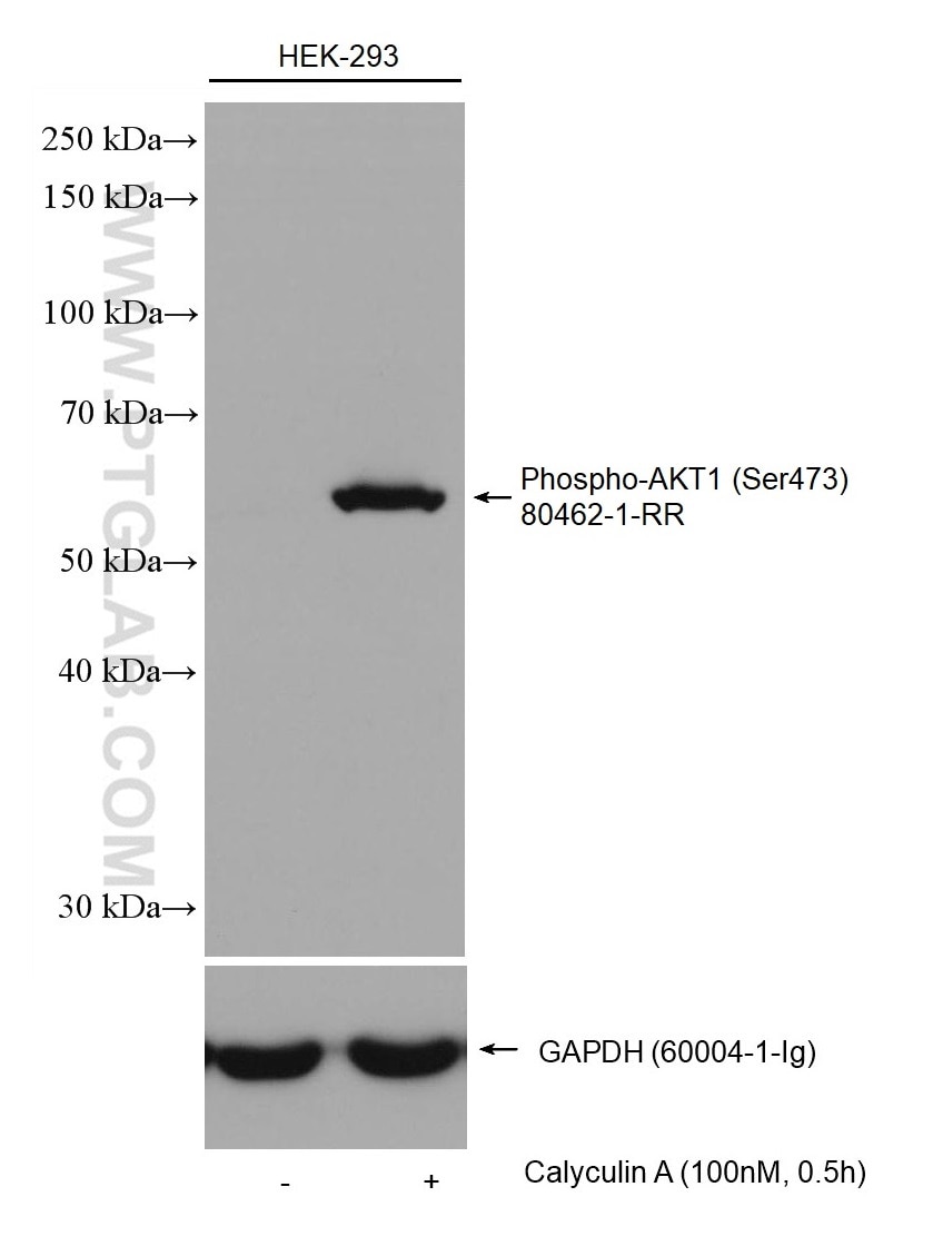 Western Blot (WB) analysis of various lysates using Phospho-AKT1 (Ser473) Recombinant antibody (80462-1-RR)