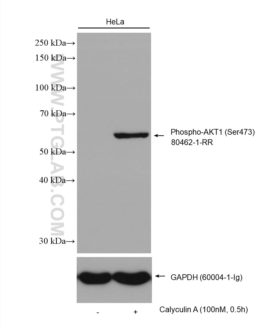 Western Blot (WB) analysis of various lysates using Phospho-AKT1 (Ser473) Recombinant antibody (80462-1-RR)