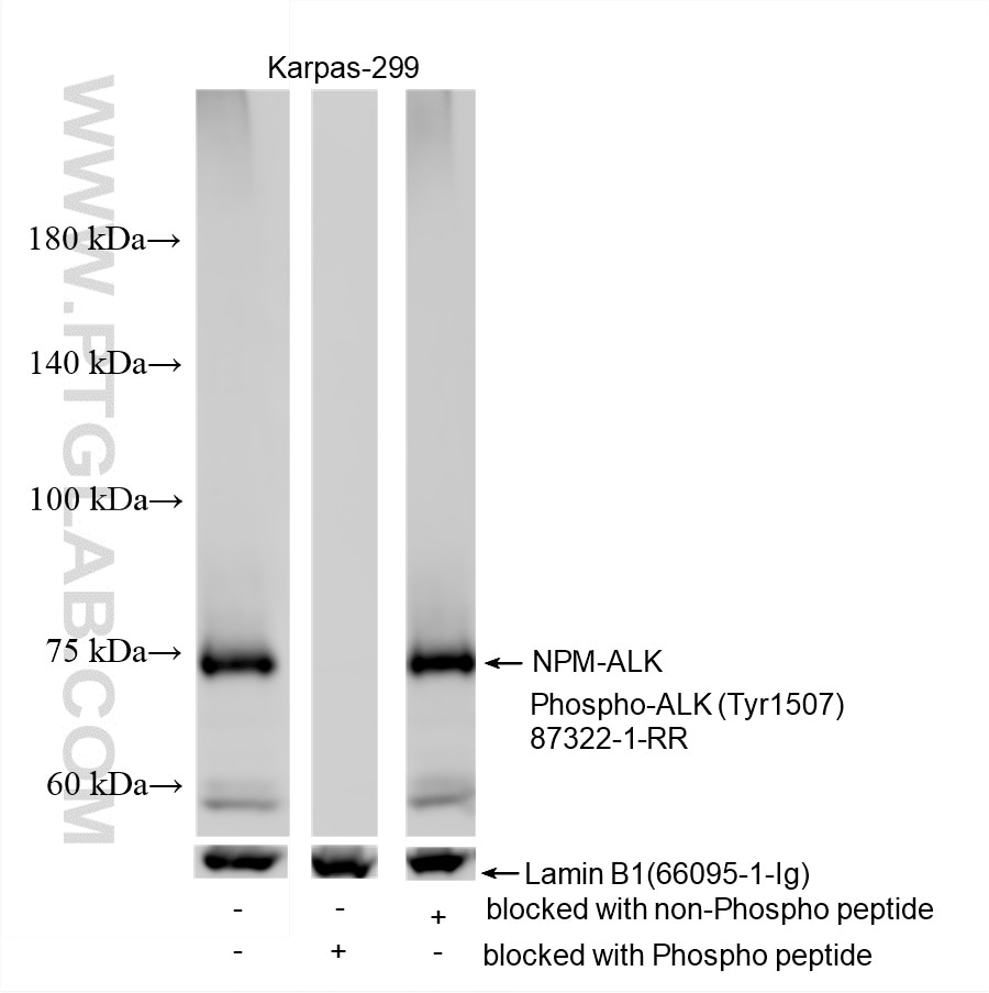 Western Blot (WB) analysis of various lysates using Phospho-ALK (Tyr1507) Recombinant monoclonal antib (87322-1-RR)
