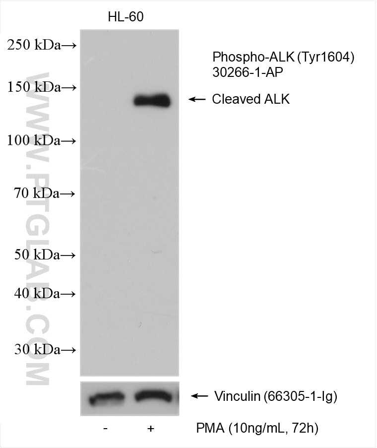 Western Blot (WB) analysis of various lysates using Phospho-ALK (Tyr1604) Polyclonal antibody (30266-1-AP)