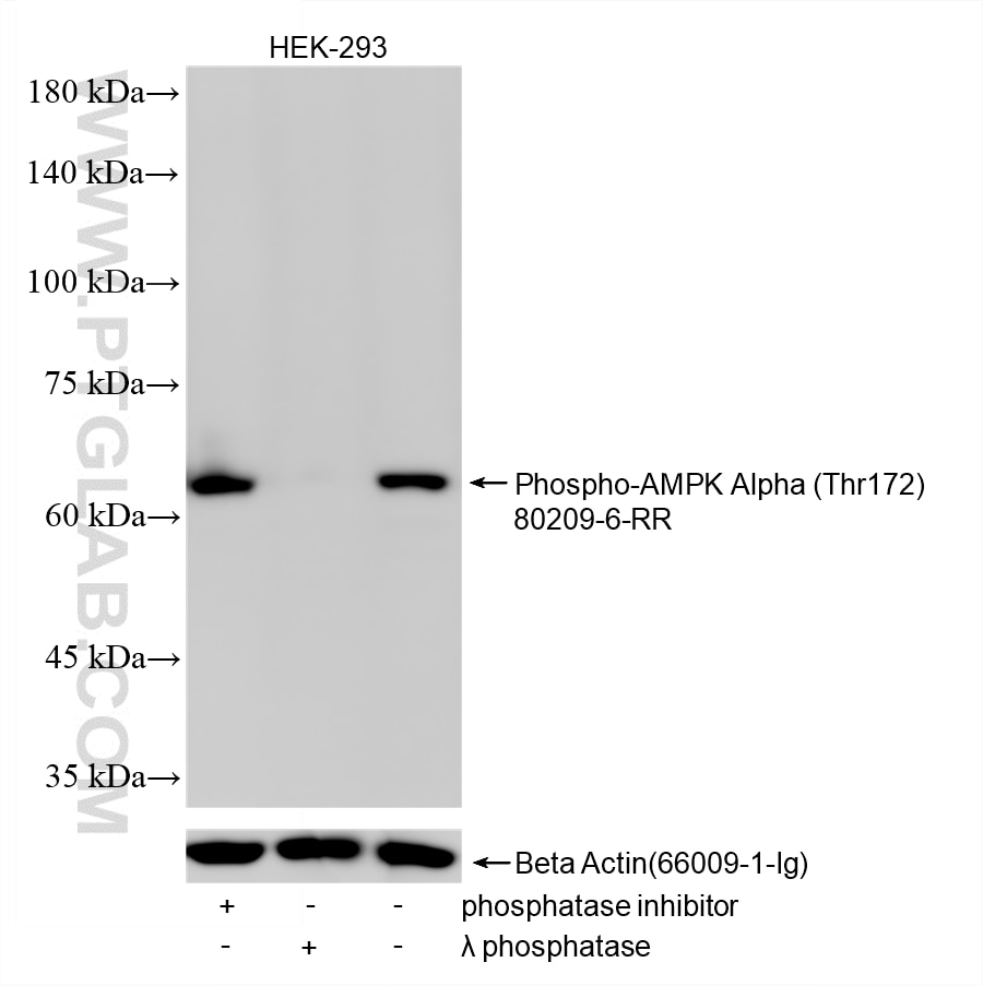 Western Blot (WB) analysis of various lysates using Phospho-AMPK Alpha (Thr172) Recombinant monoclonal (80209-6-RR)