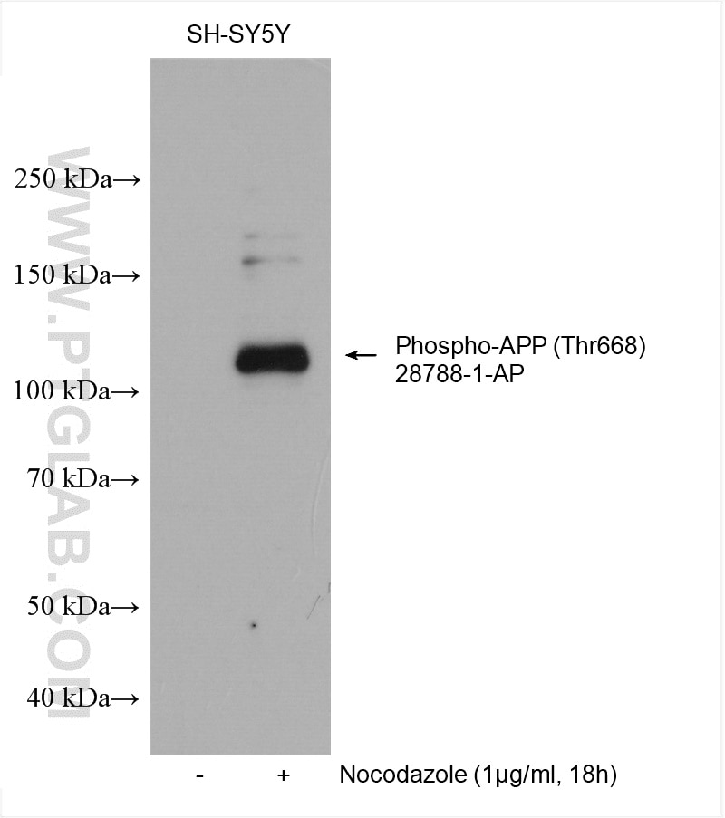 Western Blot (WB) analysis of various lysates using Phospho-APP (Thr668) Polyclonal antibody (28788-1-AP)