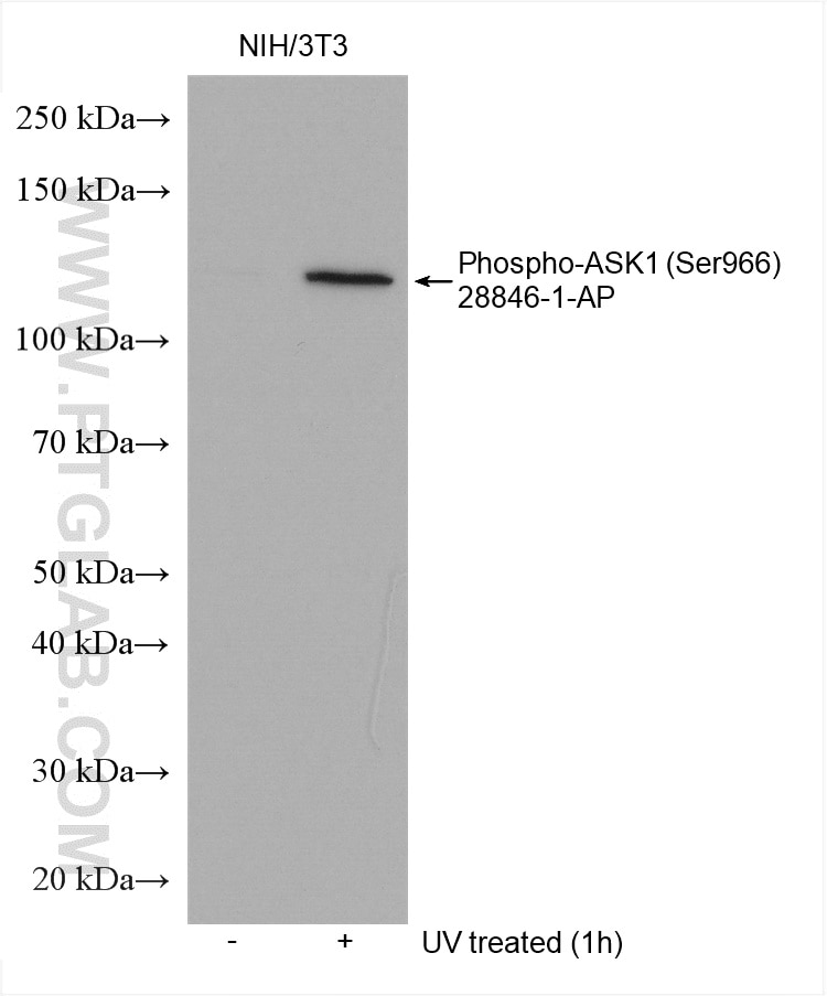 Phospho-ASK1 (Ser966)