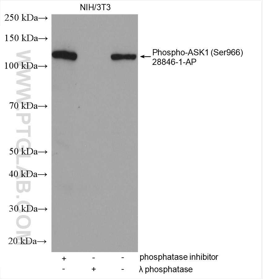 Western Blot (WB) analysis of various lysates using Phospho-ASK1 (Ser966) Polyclonal antibody (28846-1-AP)