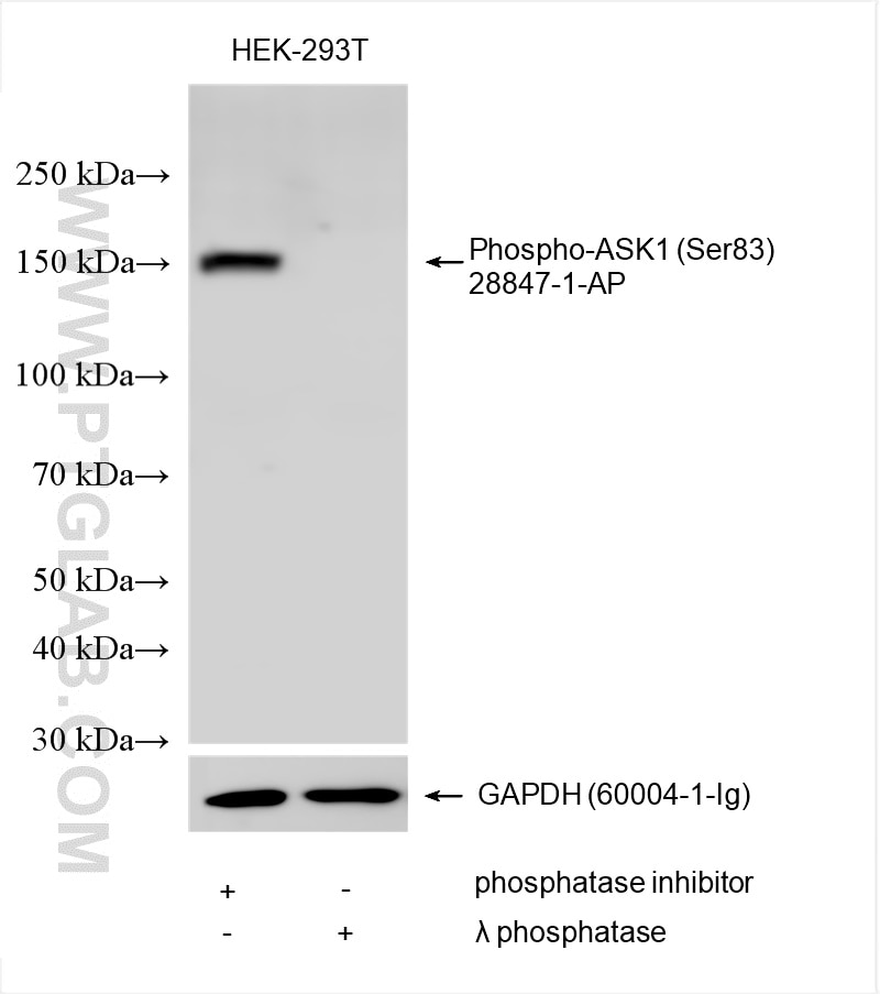 Western Blot (WB) analysis of various lysates using Phospho-ASK1 (Ser83) Polyclonal antibody (28847-1-AP)