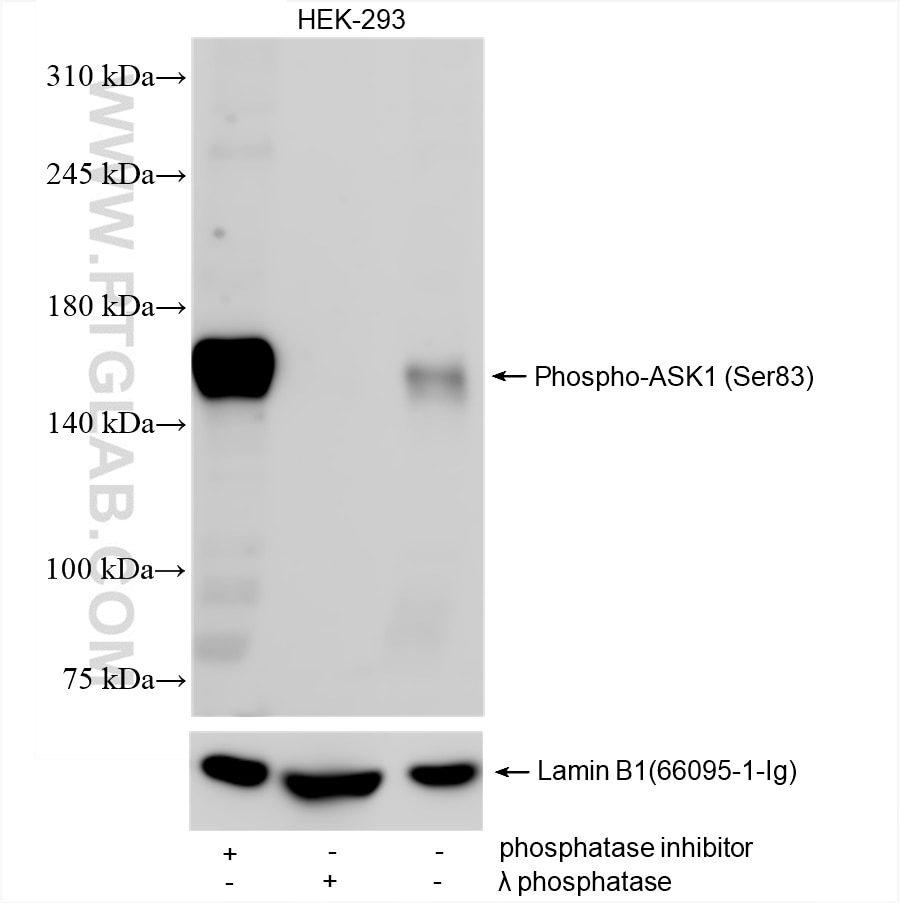 Phospho-ASK1 (Ser83)