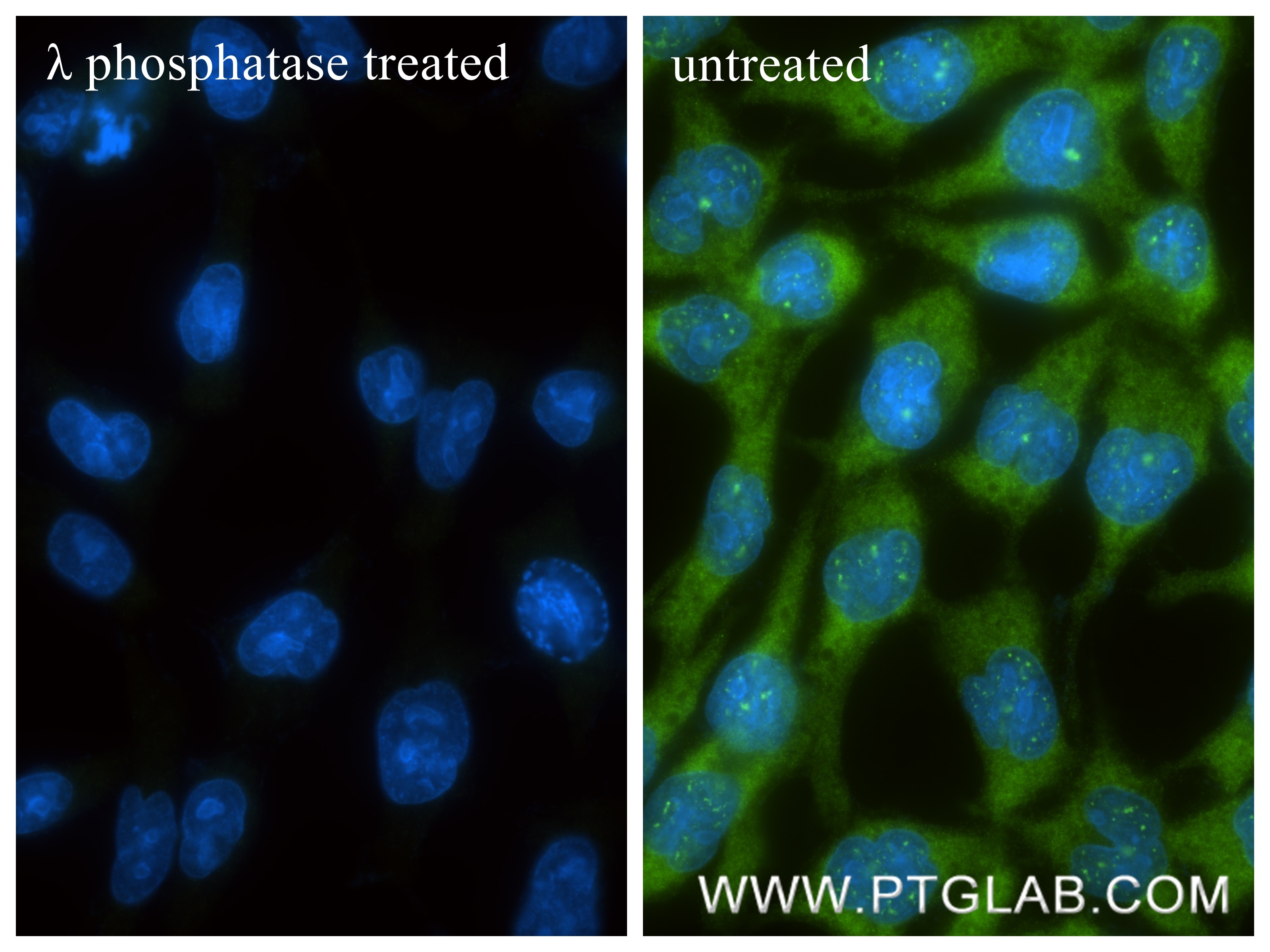 Immunofluorescence (IF) / fluorescent staining of COS-7 cells using Phospho-ASK1 (Ser966) Recombinant monoclonal antib (80142-8-RR)