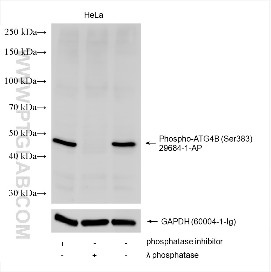 Western Blot (WB) analysis of various lysates using Phospho-ATG4B (Ser383) Polyclonal antibody (29684-1-AP)