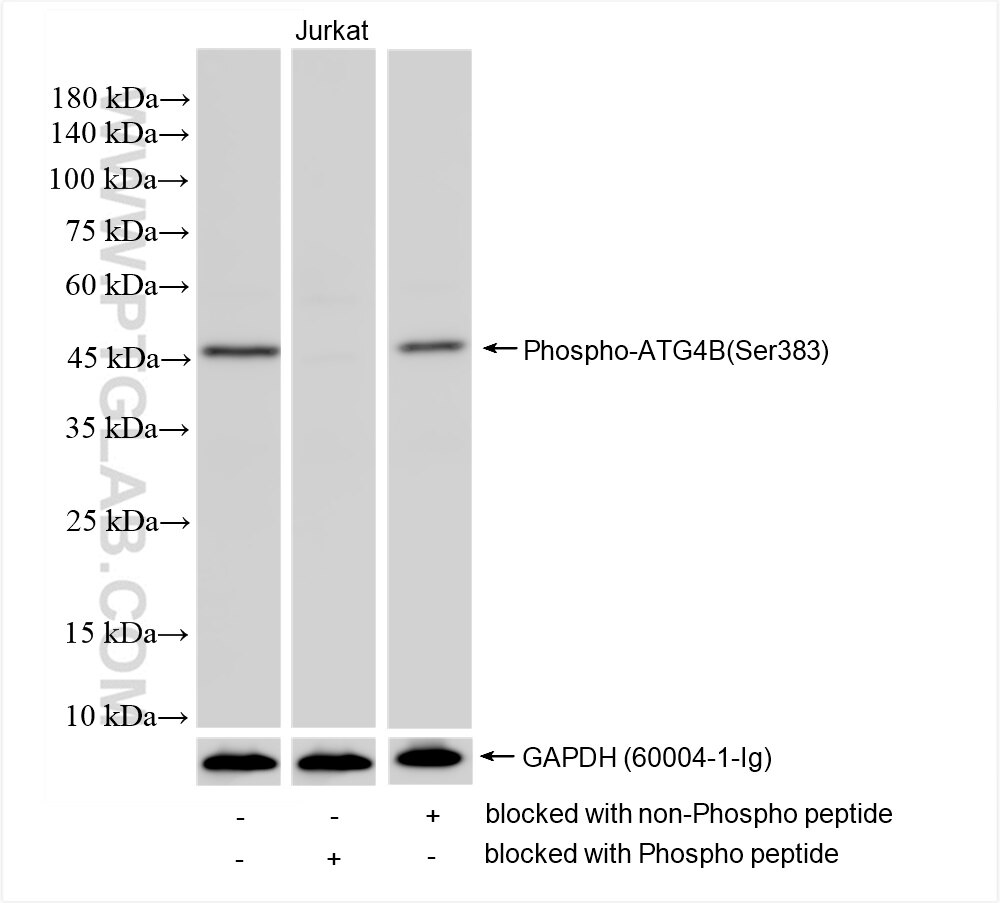 Phospho-ATG4B (Ser383)