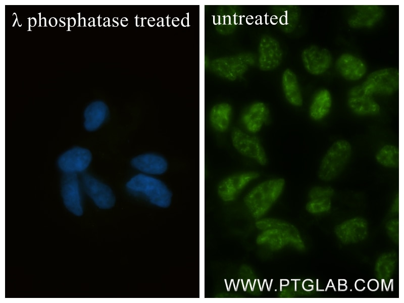 Immunofluorescence (IF) / fluorescent staining of HEK-293 cells using Phospho-ATR (Ser428) Recombinant monoclonal antibo (86330-1-RR)