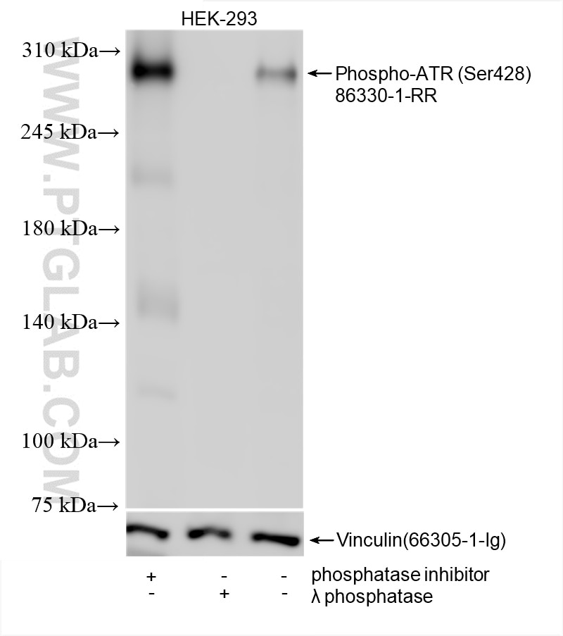 Western Blot (WB) analysis of HEK-293 cells using Phospho-ATR (Ser428) Recombinant monoclonal antibo (86330-1-RR)