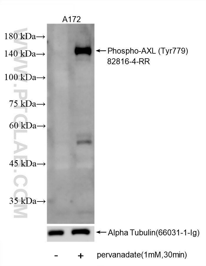 Western Blot (WB) analysis of A172 cells using Phospho-AXL (Tyr779) Recombinant antibody (82816-4-RR)