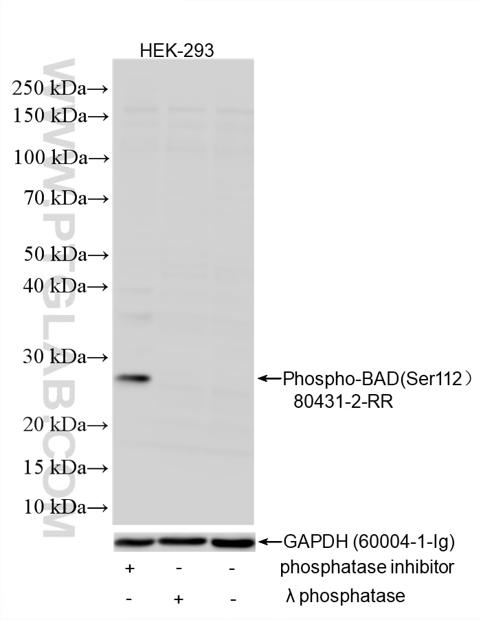 Western Blot (WB) analysis of various lysates using Phospho-BAD (Ser112) Recombinant monoclonal antibo (80431-2-RR)