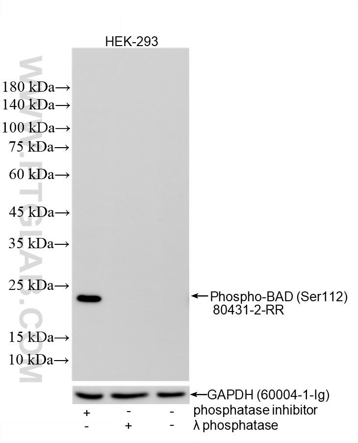 Non-treated HEK-293 cells, phosphatase inhibitor treated HEK-293 cells and λ phosphatase treated HEK-293 cells were subjected to SDS PAGE followed by western blot with 80431-2-RR (Phospho-BAD (Ser112) antibody) at dilution of 1:1000 incubated at room temperature for 1.5 hours. The membrane was stripped and re-blotted with GAPDH (60004-1-Ig) antibody as a loading control. This data was developed using the same antibody clone with 80431-2-PBS in a different storage buffer formulation. Western Blot (WB) analysis of HEK-293 cells using Phospho-BAD (Ser112) Recombinant monoclonal antibo (80431-2-RR)