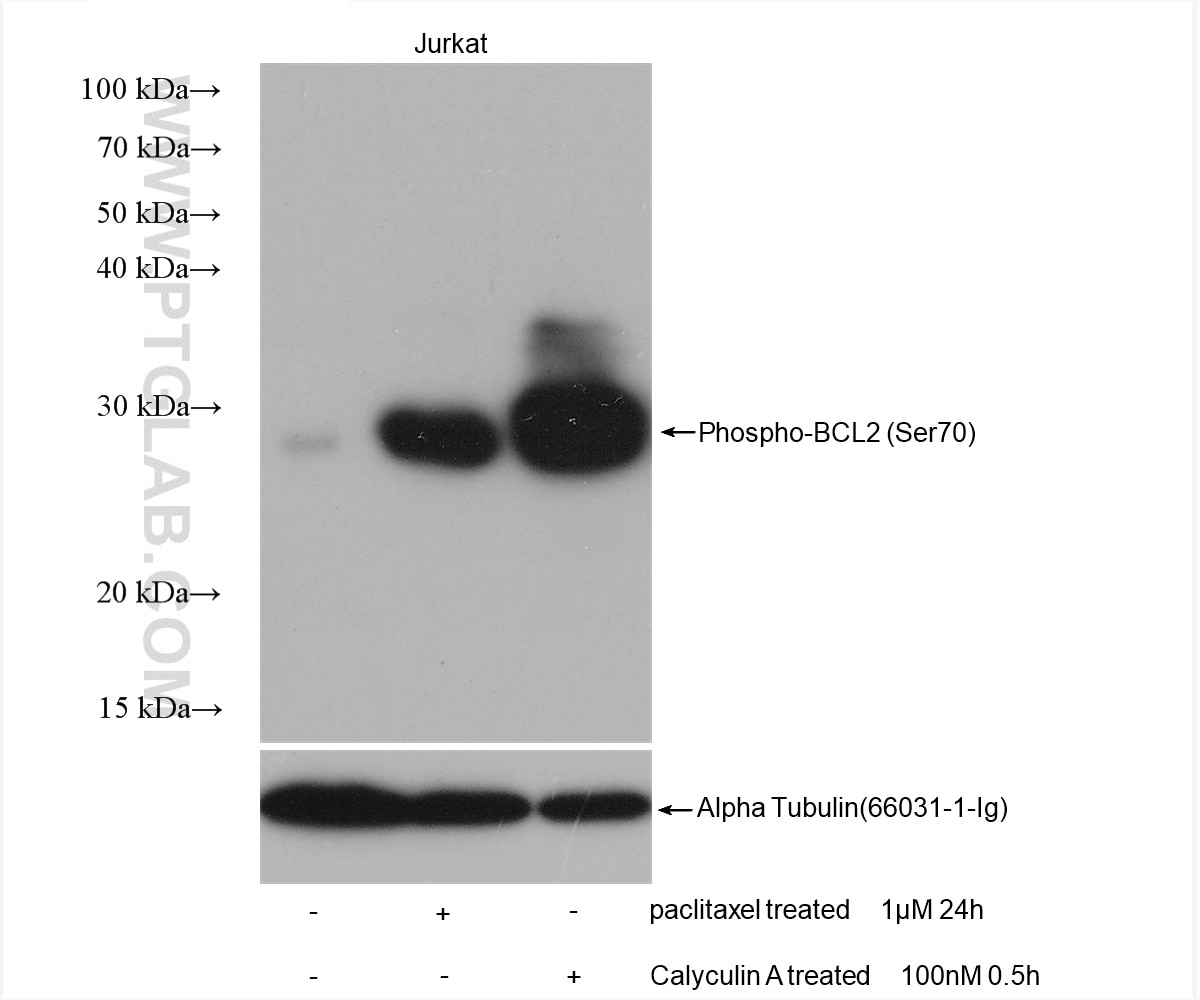 Western Blot (WB) analysis of various lysates using Phospho-BCL2 (Ser70) Recombinant antibody (80771-2-RR)