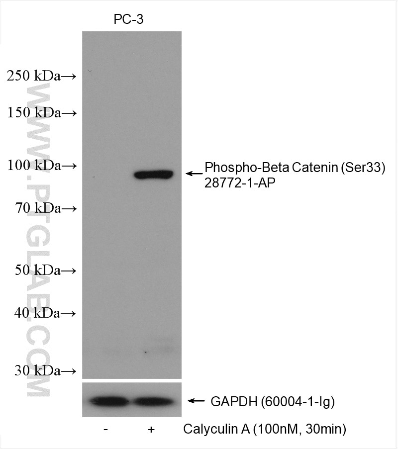Western Blot (WB) analysis of various lysates using Phospho-Beta Catenin (Ser33) Polyclonal antibody (28772-1-AP)