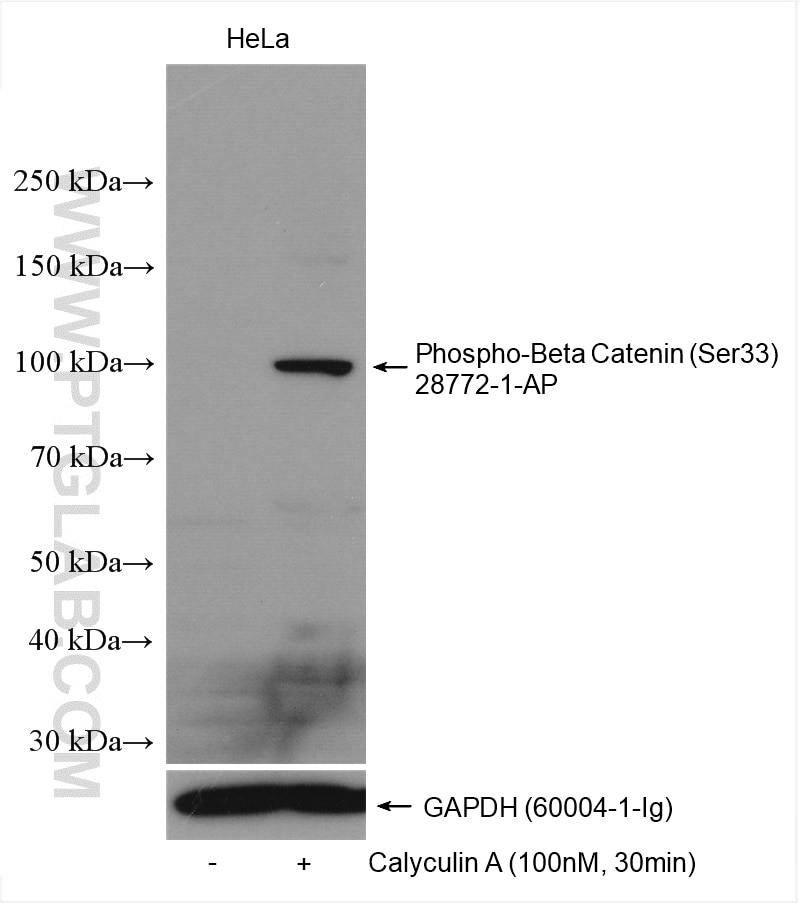 Western Blot (WB) analysis of various lysates using Phospho-Beta Catenin (Ser33) Polyclonal antibody (28772-1-AP)