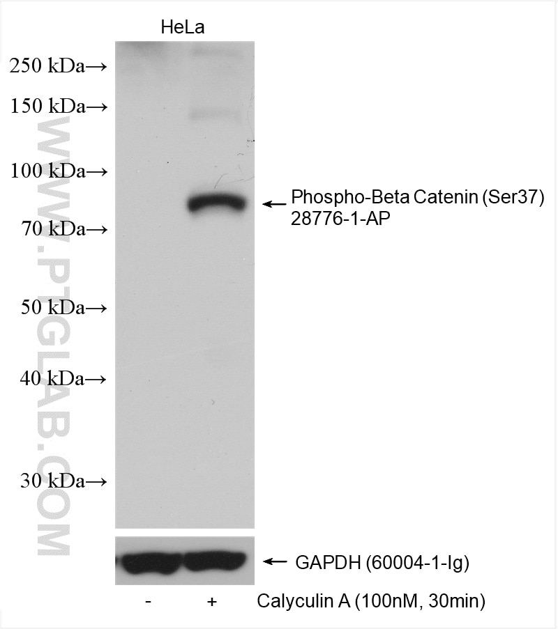 Western Blot (WB) analysis of various lysates using Phospho-Beta Catenin (Ser37) Polyclonal antibody (28776-1-AP)