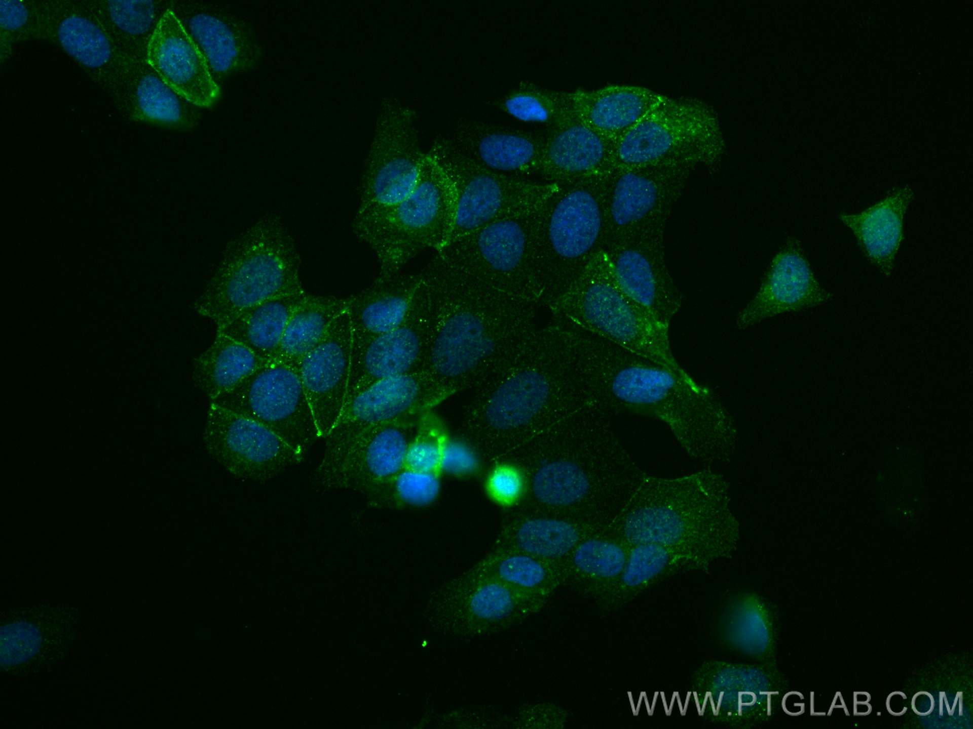 Immunofluorescence (IF) / fluorescent staining of MCF-7 cells using Phospho-Beta Catenin (Ser552) Polyclonal antibody (28778-1-AP)