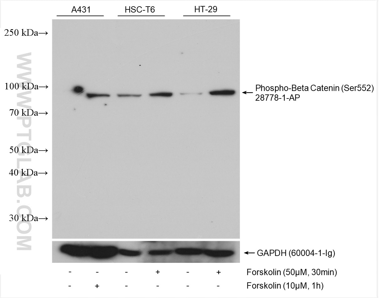 Western Blot (WB) analysis of various lysates using Phospho-Beta Catenin (Ser552) Polyclonal antibody (28778-1-AP)