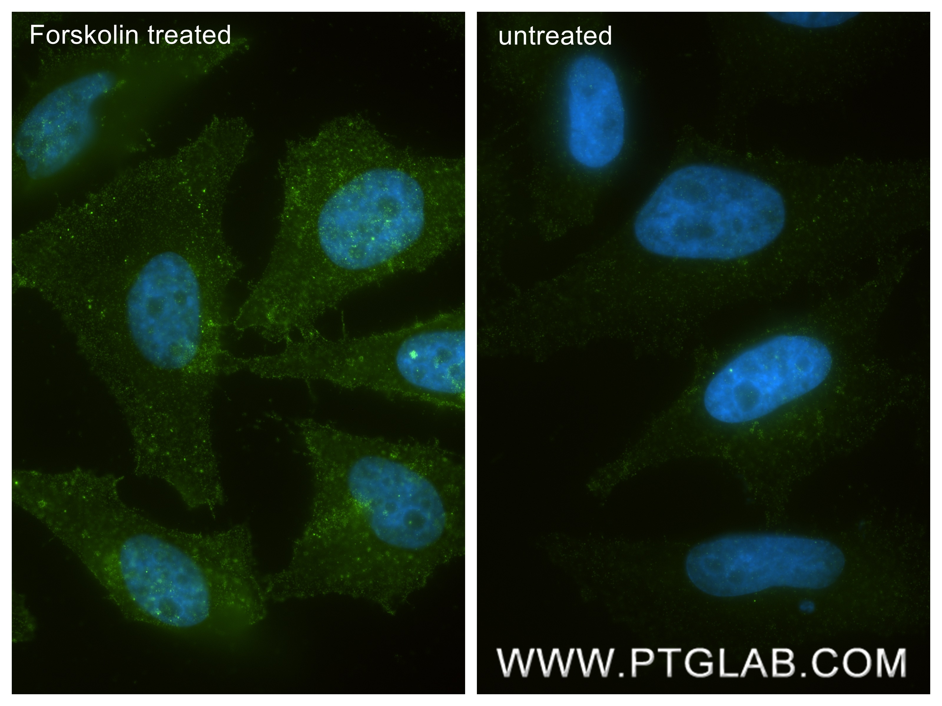 IF Staining of HeLa using 80035-2-RR Immunofluorescence (IF) / fluorescent staining of HeLa cells using Phospho-Beta Catenin (Ser552) Recombinant monoclon (80035-2-RR)