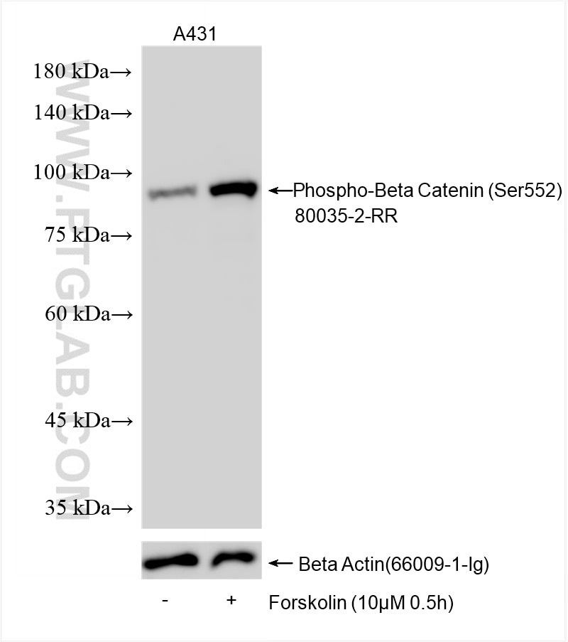 Phospho-Beta Catenin (Ser552)