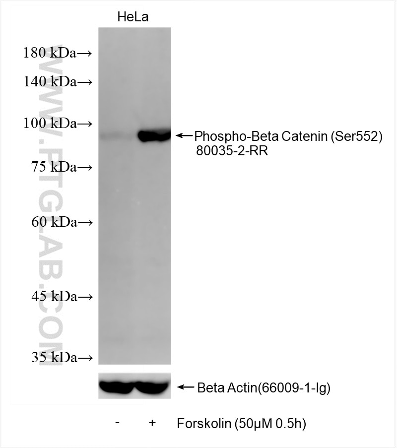 Western Blot (WB) analysis of various lysates using Phospho-Beta Catenin (Ser552) Recombinant antibody (80035-2-RR)