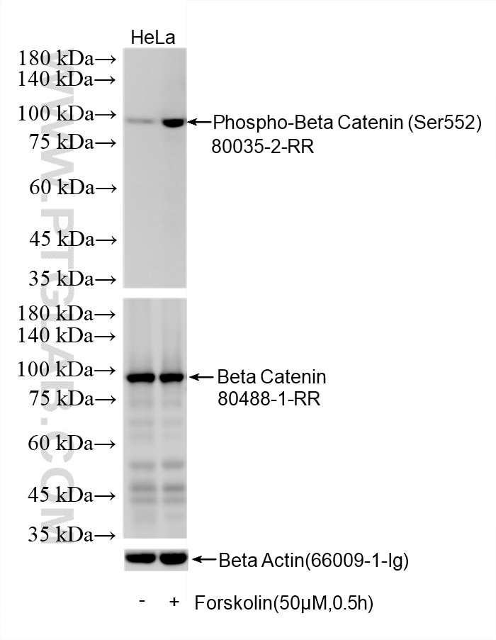 Western Blot (WB) analysis of various lysates using Phospho-Beta Catenin (Ser552) Recombinant monoclon (80035-2-RR)