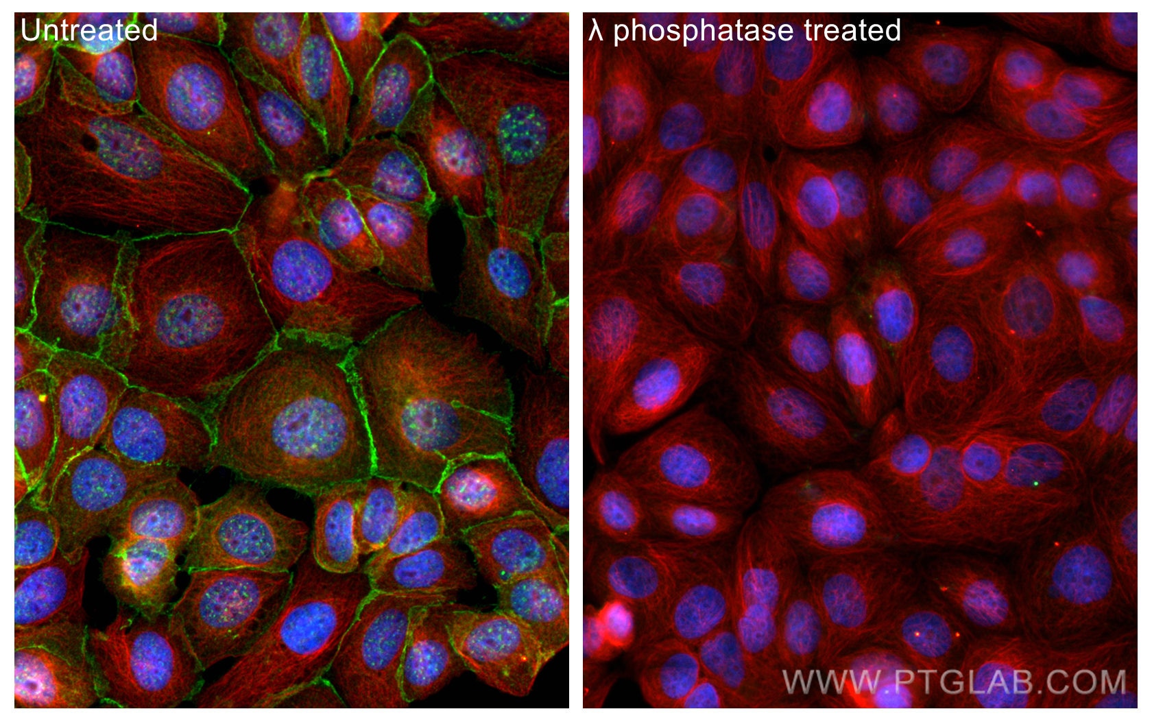 Immunofluorescence (IF) / fluorescent staining of MCF-7 cells using Phospho-Beta Catenin (Ser675) Polyclonal antibody (28853-1-AP)