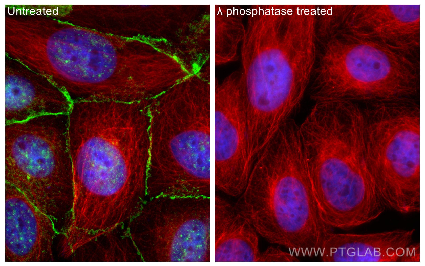 IF Staining of MCF-7 using 28853-1-AP