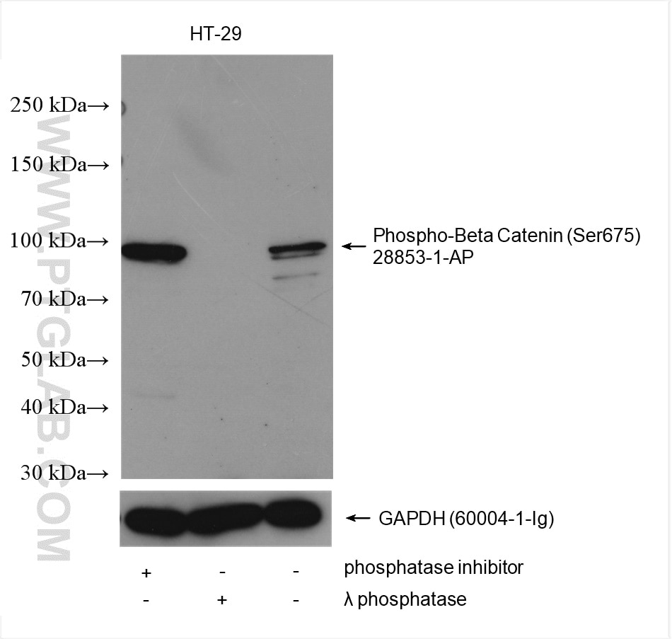 Western Blot (WB) analysis of various lysates using Phospho-Beta Catenin (Ser675) Polyclonal antibody (28853-1-AP)