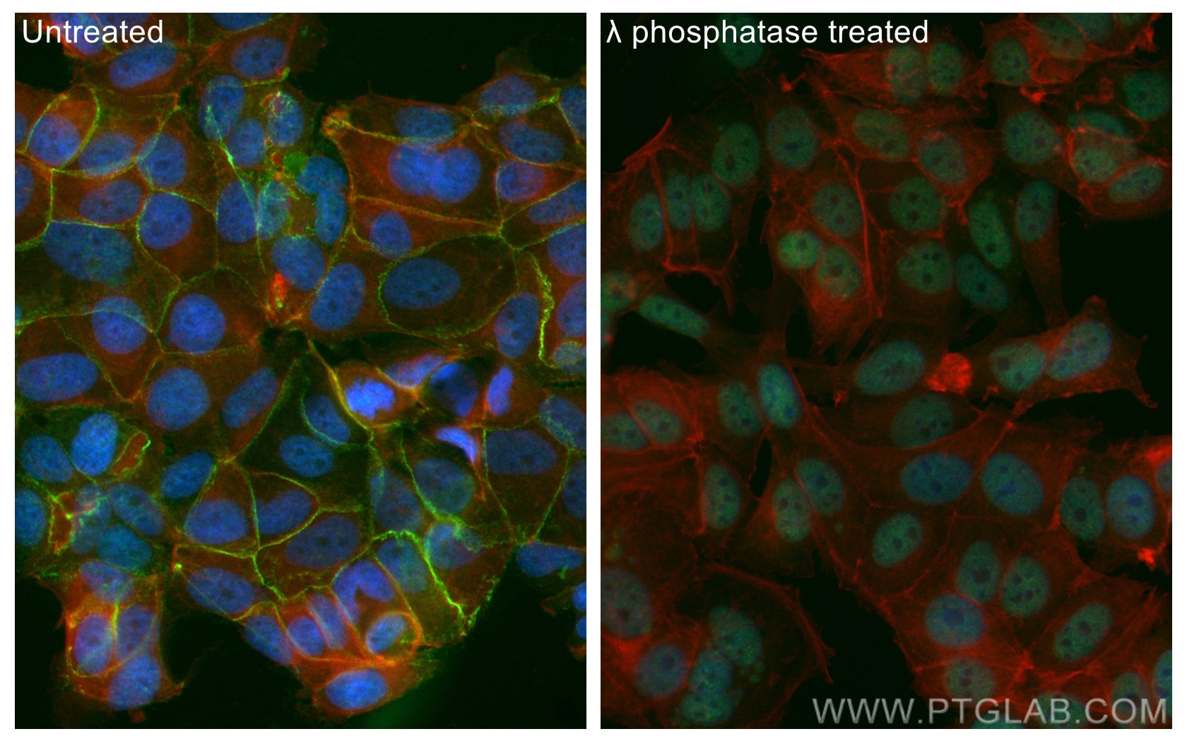 Immunofluorescence (IF) / fluorescent staining of MCF-7 cells using CoraLite® Plus 488-conjugated Phospho-Beta Catenin (CL488-80084)