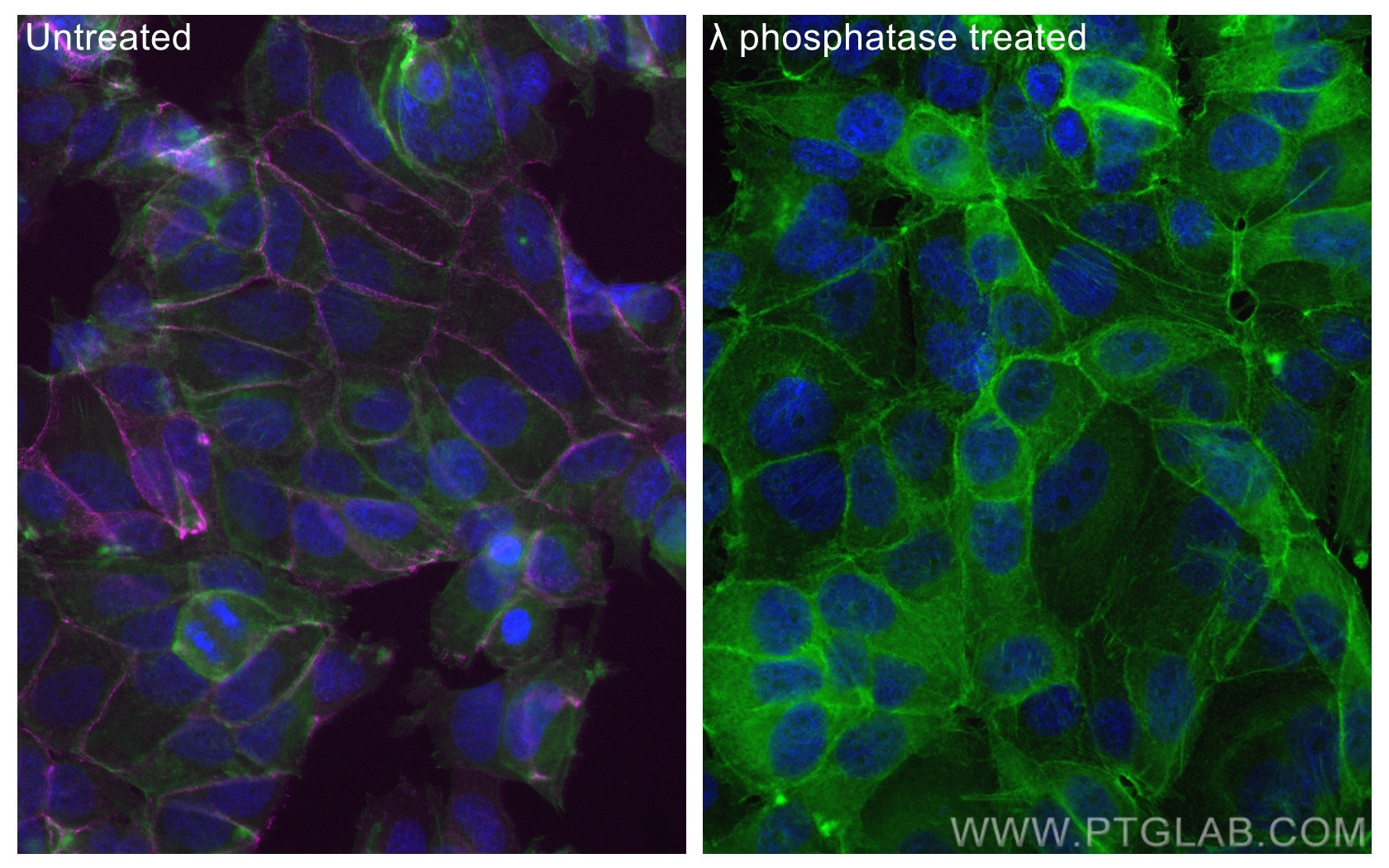 Immunofluorescence (IF) / fluorescent staining of MCF-7 cells using CoraLite® Plus 647-conjugated Phospho-Beta Catenin (CL647-80084)