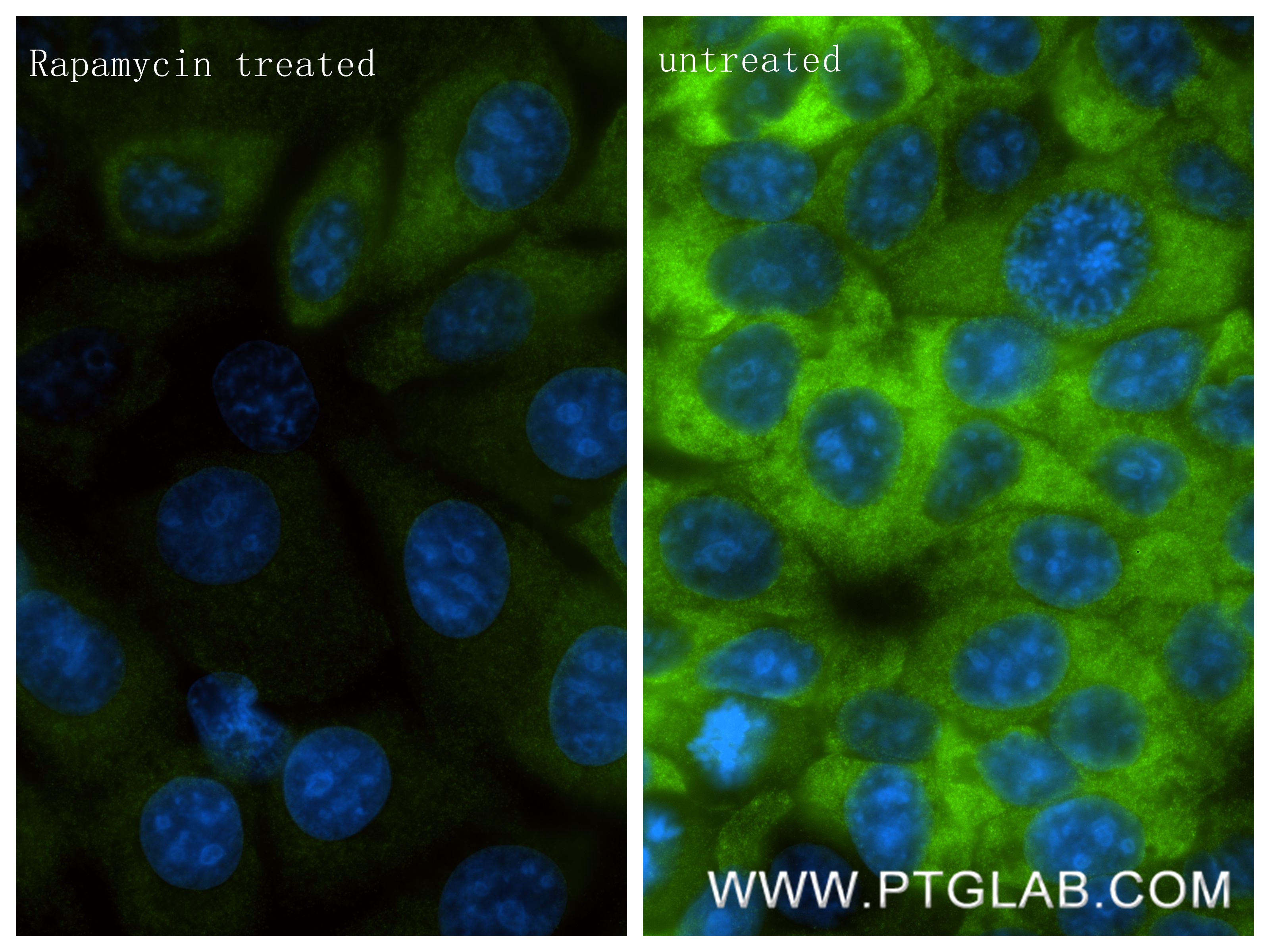 IF Staining of MCF-7 using 87337-2-RR (same clone as 87337-2-PBS) Immunofluorescence (IF) / fluorescent staining of MCF-7 cells using Phospho-CAD (Ser1859) Recombinant monoclonal antib (87337-2-RR)