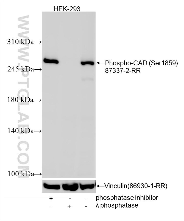 WB analysis using 87337-2-RR (same clone as 87337-2-PBS) Western Blot (WB) analysis of various lysates using Phospho-CAD (Ser1859) Recombinant monoclonal antib (87337-2-RR)