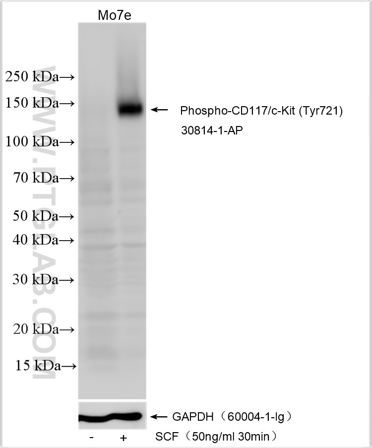 Western Blot (WB) analysis of various lysates using Phospho-CD117/c-Kit (Tyr721) Polyclonal antibody (30814-1-AP)