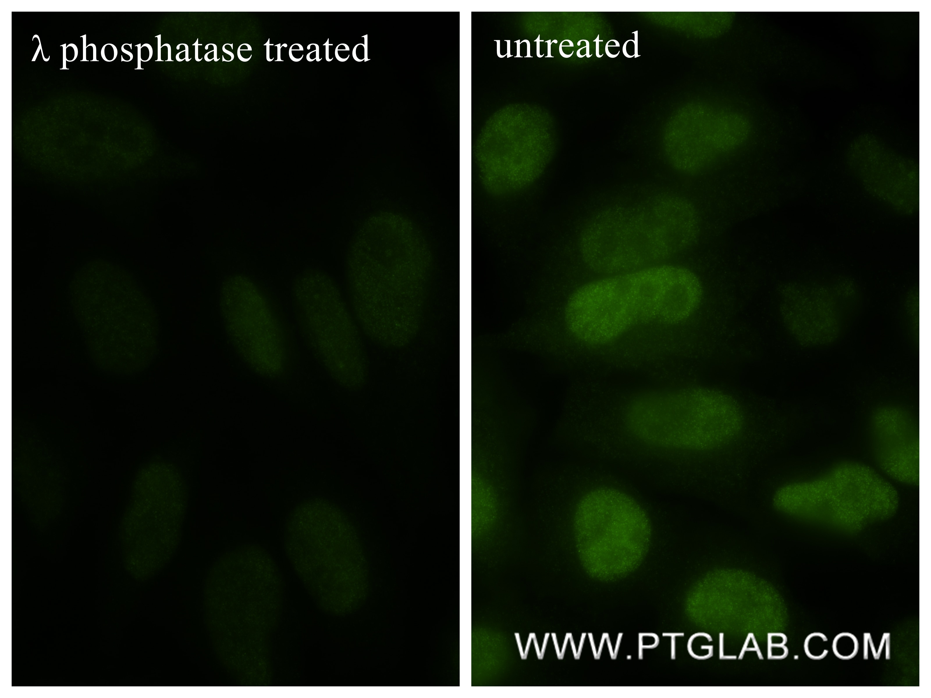 Immunofluorescence (IF) / fluorescent staining of HeLa cells using Phospho-CDK1/CDC2 (Tyr15) Recombinant monoclonal a (82751-5-RR)