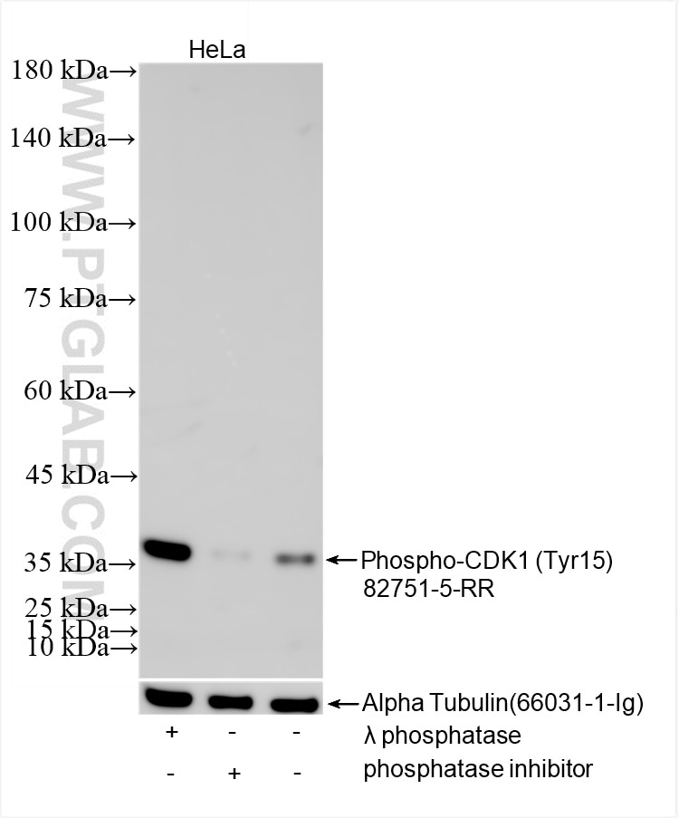 Western Blot (WB) analysis of HeLa cells using Phospho-CDK1 (Tyr15) Recombinant antibody (82751-5-RR)