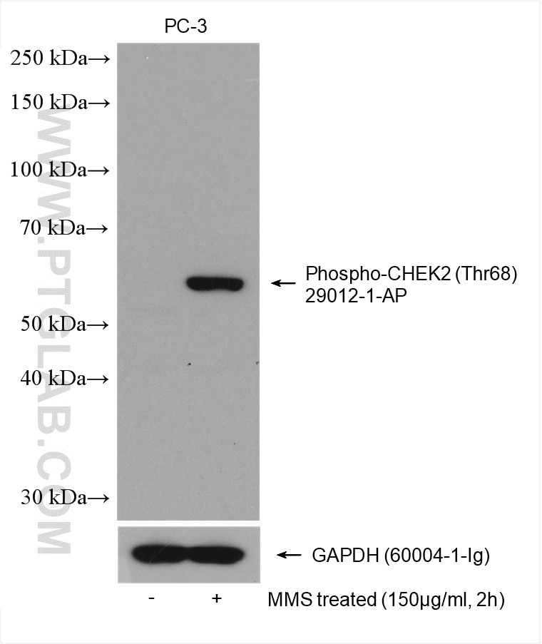 Western Blot (WB) analysis of various lysates using Phospho-CHEK2 (Thr68) Polyclonal antibody (29012-1-AP)