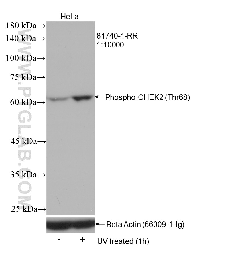 Western Blot (WB) analysis of HeLa cells using Phospho-CHEK2 (Thr68) Recombinant antibody (81740-1-RR)