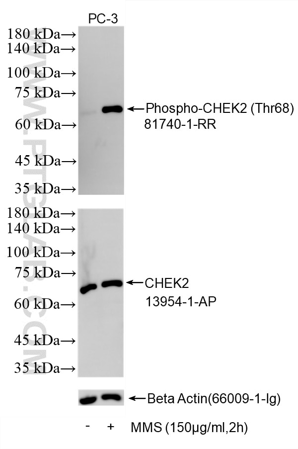 Western Blot (WB) analysis of various lysates using Phospho-CHEK2 (Thr68) Recombinant monoclonal antib (81740-1-RR)