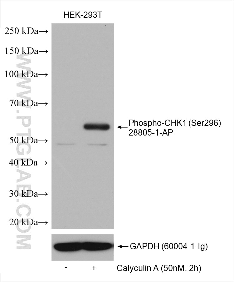 Western Blot (WB) analysis of various lysates using Phospho-Chk1 (Ser296) Polyclonal antibody (28805-1-AP)