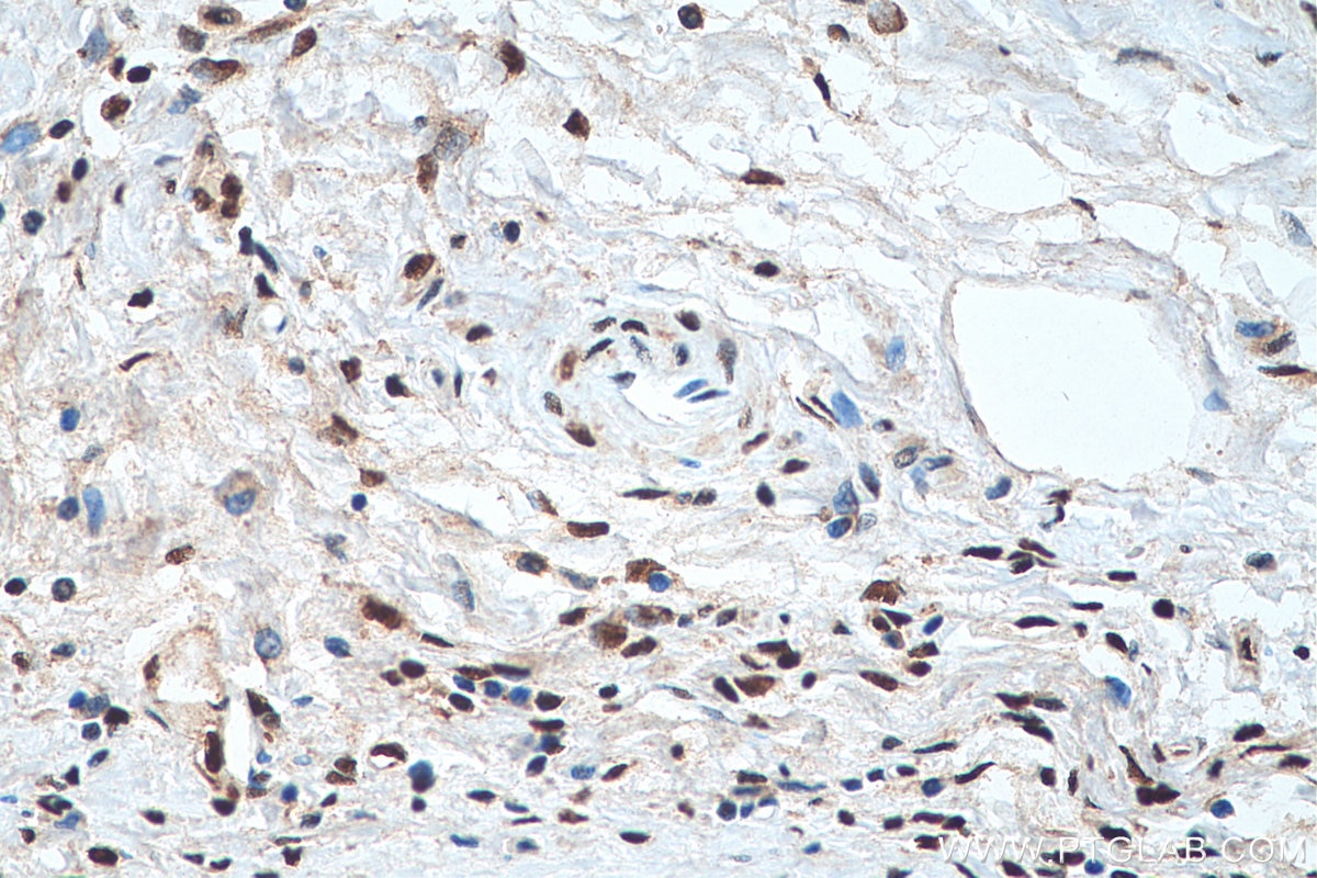 Immunohistochemistry (IHC) staining of human liver tissue using Phospho-CREB1 (Ser133) Polyclonal antibody (28792-1-AP)